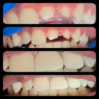 Texas Smiles dental center
