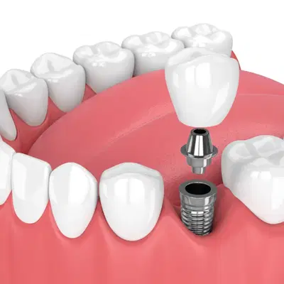 Awesome Smiles: Provenghi Tracy DDS