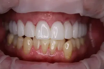 Christian Lassen DDS