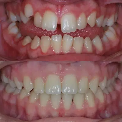Farr West Orthodontics