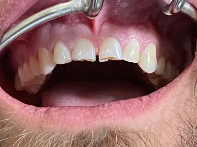 Avenues Dentistry Salt Lake City
