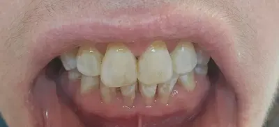 United Smiles