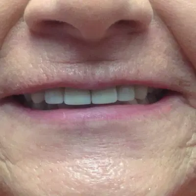 Burton Family Dentistry