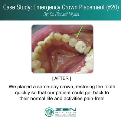 Zen Dental Center Family Cosmetic Emergency Implants