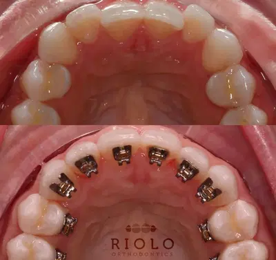Riolo Orthodontics