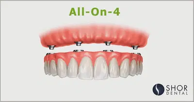 Shor Dental